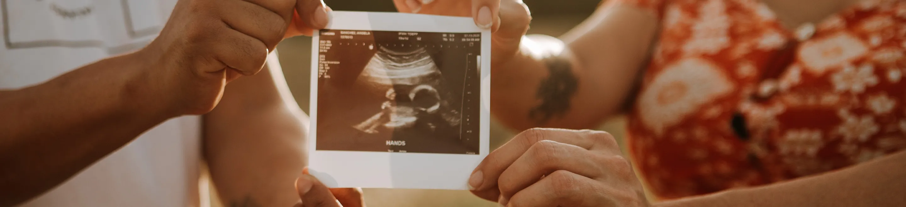 Zwei Personen halten ein Ultraschallbild mit einem Baby in der Hand.