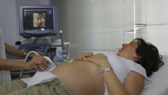 Eine Schwangere bei der Ultraschalluntersuchung.